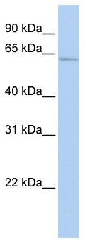 WB Suggested Anti-SOX30 Antibody Titration: 0.2-1 ug/ml; ELISA Titer: 1: 312500; Positive Control: HepG2 cell lysate