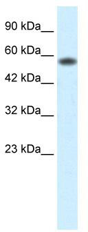 WB Suggested Anti-PCYOX1 Antibody Titration: 0.5ug/ml; Positive Control: Jurkat cell lysate