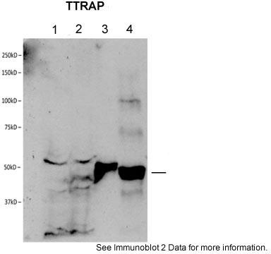 Host: Rabbit Target Name: NOM1 Sample Tissue: Human 293T Whole Cell lysates Antibody Dilution: 1ug/ml