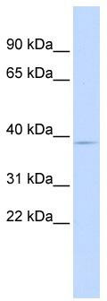 WB Suggested Anti-PITX3 Antibody Titration: 0.2-1 ug/ml; ELISA Titer: 1: 312500; Positive Control: Human Liver