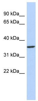 WB Suggested Anti-PITX3 Antibody Titration: 0.2-1 ug/ml; ELISA Titer: 1: 12500; Positive Control: MCF7 cell lysate