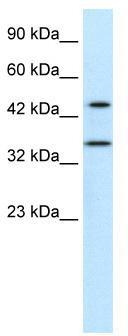 WB Suggested Anti-PNMA1 Antibody Titration: 0.2-1 ug/ml; Positive Control: Jurkat cell lysate