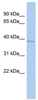 WB Suggested Anti-PNMA1 Antibody Titration: 0.2-1 ug/ml; ELISA Titer: 1: 312500; Positive Control: HT1080 cell lysatePNMA1 is supported by BioGPS gene expression data to be expressed in HT1080