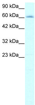 WB Suggested Anti-IVNS1ABP Antibody Titration: 2.0ug/ml; Positive Control: HepG2 cell lysate