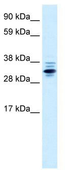 WB Suggested Anti-ZNF654 Antibody Titration: 0.2-1 ug/ml; Positive Control: Human Lung