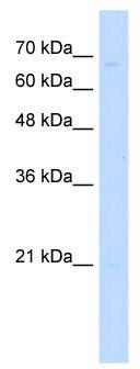 WB Suggested Anti-ZNF654 Antibody Titration: 0.2-1 ug/ml; Positive Control: 721_B cell lysateZNF654 is supported by BioGPS gene expression data to be expressed in 721_B