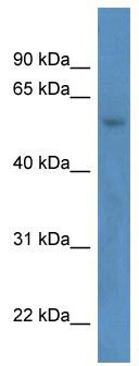 WB Suggested Anti-ZNF692 Antibody Titration: 0.2-1 ug/ml; ELISA Titer: 1: 2500; Positive Control: ACHN cell lysate