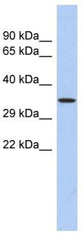 WB Suggested Anti-PRDM12 Antibody Titration: 0.2-1 ug/ml; ELISA Titer: 1: 62500; Positive Control: Human Thymus