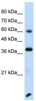 Host: Rabbit; Target Name: RFX4; Sample Tissue: Transfected 293T Whole Cell lysates; Antibody Dilution: 1.0ug/ml