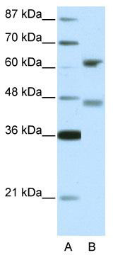 WB Suggested Anti-RFX4 Antibody Titration: 5.0ug/ml; ELISA Titer: 1: 1562500; Positive Control: 293T cell lysate