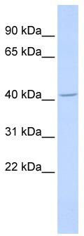 WB Suggested Anti-ALX4 Antibody Titration: 0.2-1 ug/ml; ELISA Titer: 1: 12500; Positive Control: Human Muscle