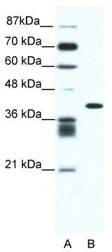 WB Suggested Anti-ALX4 Antibody Titration: 0.2-1 ug/ml; ELISA Titer: 1: 12500; Positive Control: Jurkat cell lysate