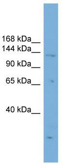 WB Suggested Anti-PRDM16 Antibody Titration: 0.2-1 ug/ml; ELISA Titer: 1: 62500; Positive Control: HepG2 cell lysate