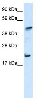 WB Suggested Anti-ZNFN1A5 Antibody Titration: 0.2-1 ug/ml; ELISA Titer: 1:312500; Positive Control: Human muscle