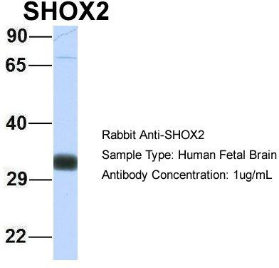 Host: Rabbit; Target Name: SHOX2; Sample Tissue: Human Fetal Brain; Antibody Dilution: 1.0 ug/ml