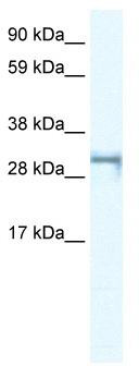WB Suggested Anti-SHOX2 Antibody Titration: 0.2-1 ug/ml; ELISA Titer: 1:62500; Positive Control: Jurkat cell lysate