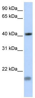 WB Suggested Antibody Titration: 0.2-1 ug/ml; Positive Control: Jurkat
