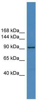 WB Suggested Anti-ZNF574 Antibody Titration: 0.2-1 ug/ml; ELISA Titer: 1:312500; Positive Control: COLO205 cell lysate