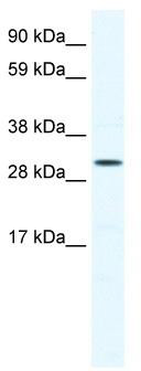 WB Suggested Anti-SOX12 Antibody Titration: 0.2-1 ug/ml; ELISA Titer: 1:62500; Positive Control: Jurkat cell lysate