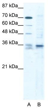 WB Suggested Anti-SOX12 Antibody; Titration: 1.25 ug/ml; Positive Control: Jurkat Whole Cell