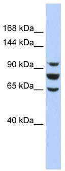 WB Suggested Anti-EPC1 Antibody Titration: 0.2-1 ug/ml; ELISA Titer: 1:312500; Positive Control: HepG2 cell lysate