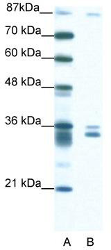 WB Suggested Anti-PKNOX2 Antibody Titration: 1.25 ug/ml; ELISA Titer: 1:62500; Positive Control: Jurkat cell lysate