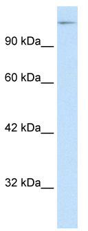 WB Suggested Anti-SUPT5H Antibody Titration: 0.2-1 ug/ml; ELISA Titer: 1:62500; Positive Control: HepG2 cell lysate