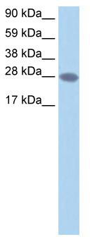 WB Suggested Anti-TCEA2 Antibody Titration: 1.25 ug/ml; Positive Control: Human brain
