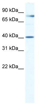 WB Suggested Anti-TEAD3 Antibody Titration: 0.2-1 ug/ml; Positive Control: Human Placenta