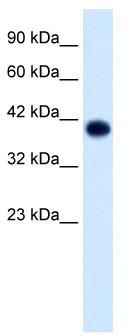 WB Suggested Anti-TFAP4 Antibody Titration: 1.25 ug/ml; ELISA Titer: 1:312500; Positive Control: Jurkat cell lysate
