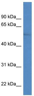 WB Suggested Anti-ZIC1 Antibody Titration: 0.2-1 ug/ml; ELISA Titer: 1:12500; Positive Control: ACHN cell lysate