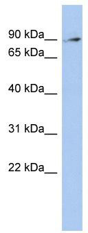 WB Suggested Anti-ZNF711 Antibody Titration: 0.2-1 ug/ml; ELISA Titer: 1:312500; Positive Control: OVCAR-3 cell lysate