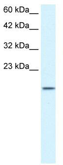 WB Suggested Anti-ZNF7 Antibody Titration: 1.25 ug/ml; Positive Control: Jurkat cell lysateZNF7 is supported by BioGPS gene expression data to be expressed in Jurkat