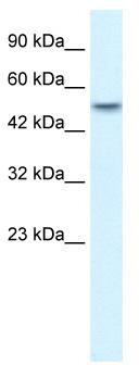 WB Suggested Anti-ANKRD11 Antibody Titration: 1.25 ug/ml; Positive Control: Human Placenta