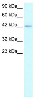 WB Suggested Anti-ZNF207 Antibody Titration: 1.1 ug/ml; Positive Control: HepG2 cell lysate