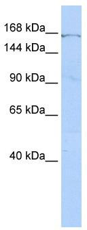 WB Suggested Anti-ZNF236 Antibody Titration: 0.2-1 ug/ml; ELISA Titer: 1:1562500; Positive Control: HepG2 cell lysateZNF236 is supported by BioGPS gene expression data to be expressed in HepG2