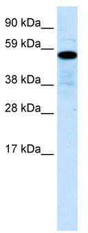 WB Suggested Anti-ZNF426 Antibody Titration: 0.2-1 ug/ml; ELISA Titer: 1:312500; Positive Control: Human Liver