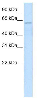 WB Suggested Anti-ZNF426 Antibody; Titration: 2.5 ug/ml; Positive Control: Fetal Liver