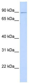 WB Suggested Anti-ZNF408 Antibody Titration: 0.2-1 ug/ml; ELISA Titer: 1:312500; Positive Control: Transfected 293T