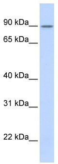 WB Suggested Anti-ZNF408 Antibody Titration: 0.2-1 ug/ml; ELISA Titer: 1:1562500; Positive Control: Transfected 293T