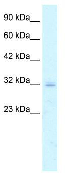 WB Suggested Anti-CLDN15 Antibody Titration: 5.0 ug/ml; Positive Control: Jurkat cell lysate