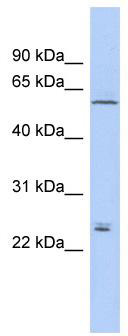 WB Suggested Anti-CLDN15 Antibody Titration: 0.2-1 ug/ml; ELISA Titer: 1:62500; Positive Control: THP-1 cell lysate