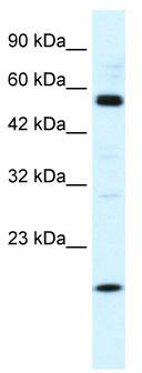 WB Suggested Anti-ZNF436 Antibody Titration: 1.25 ug/ml; Positive Control: HepG2 cell lysate