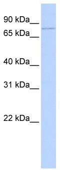 WB Suggested Anti-ZBTB39 Antibody Titration: 0.2-1 ug/ml; ELISA Titer: 1:312500; Positive Control: Hela cell lysate