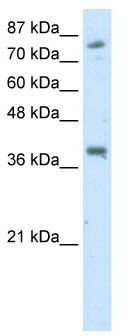 WB Suggested Anti-TSC22D2 Antibody Titration: 2.5 ug/ml; Positive Control: Transfected 293T