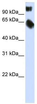 WB Suggested Anti-TSC22D2 Antibody Titration: 0.2-1 ug/ml; ELISA Titer: 1:62500; Positive Control: Transfected 293T