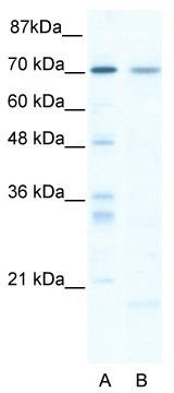 WB Suggested Anti-SOX13 Antibody Titration: 5.0 ug/ml; ELISA Titer: 1:62500; Positive Control: HepG2 cell lysateSOX13 is strongly supported by BioGPS gene expression data to be expressed in Human HepG2 cells