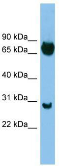 WB Suggested Anti-SOX13 Antibody Titration: 0.2-1 ug/ml; ELISA Titer: 1:62500; Positive Control: ACHN cell lysate