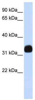 WB Suggested Anti-MED27 Antibody Titration: 0.2-1 ug/ml; ELISA Titer: 1:62500; Positive Control: Human brain
