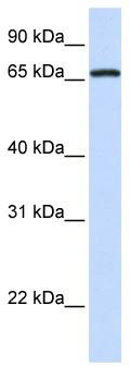 WB Suggested Anti-MED26 Antibody Titration: 0.2-1 ug/ml; ELISA Titer: 1:12500; Positive Control: Human brain